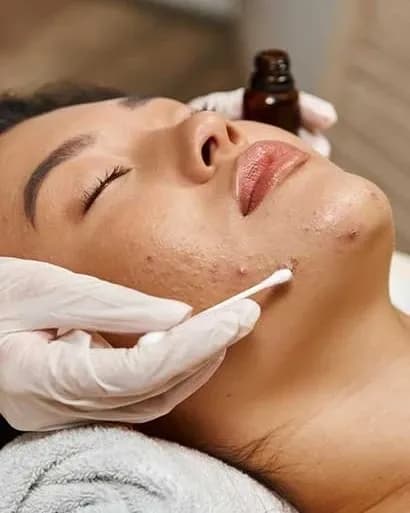 https://hypeready-admin-prod.s3.amazonaws.com/closebi-prod/Acne-Treatment-DCP19