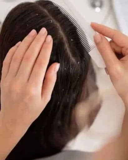 https://hypeready-admin-prod.s3.amazonaws.com/closebi-prod/Dandruff-Treatment-DCP30