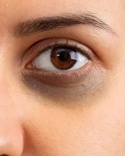 https://hypeready-admin-prod.s3.amazonaws.com/closebi-prod/Dark-Circles-DCP47