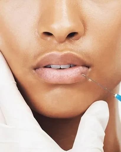 https://hypeready-admin-prod.s3.amazonaws.com/closebi-prod/Dermal-Fillers-Treatment-DCP33