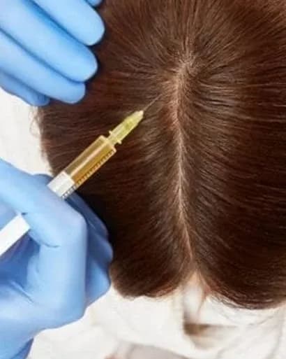 https://hypeready-admin-prod.s3.amazonaws.com/closebi-prod/PRP-Hair-Treatment-DCP26